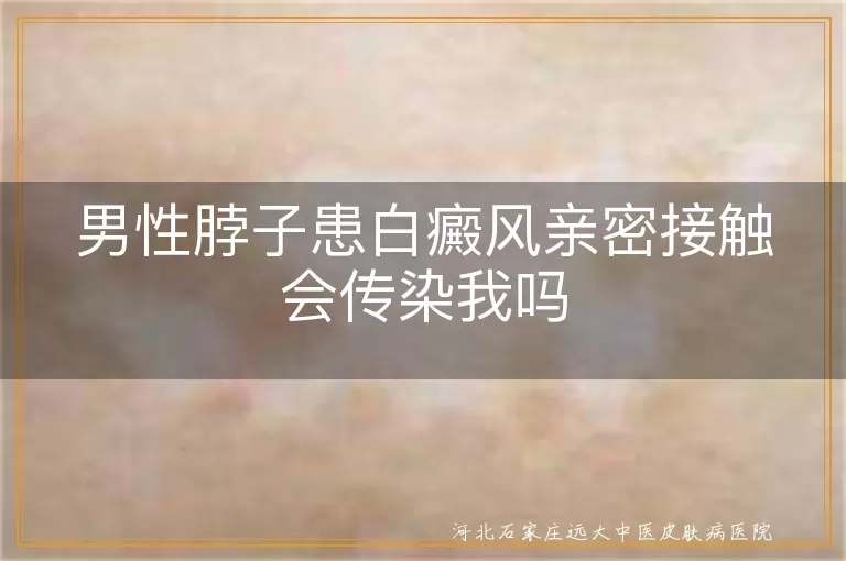 男性脖子患白癜风亲密接触会传染我吗