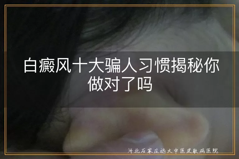 白癜风错误习惯揭秘你做对了吗,白斑治疗误区揭秘你做对了吗,白癜风护理误区揭秘你做对了吗
