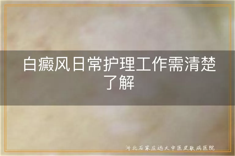 白癜风日常护理工作需清楚了解