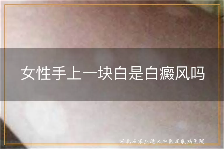 女性手上一块白是白癜风吗