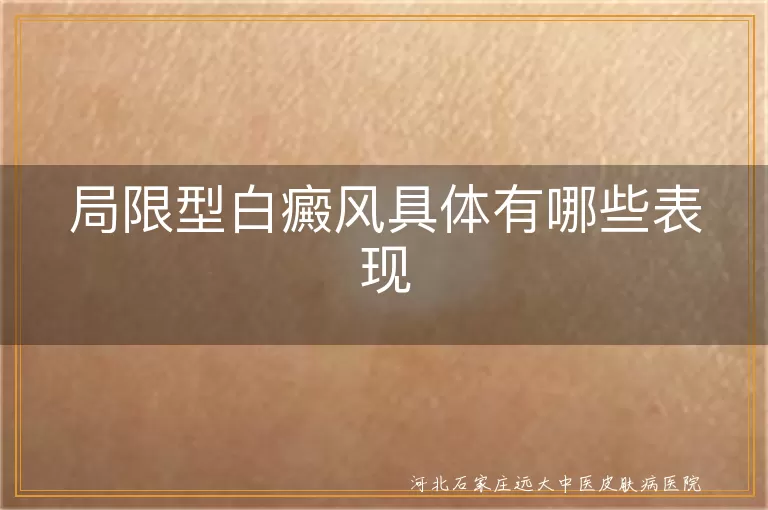 局限型白癜风有哪些症状表现,局限型白斑的症状表现是什么,局限型白癜风的主要表现有哪些