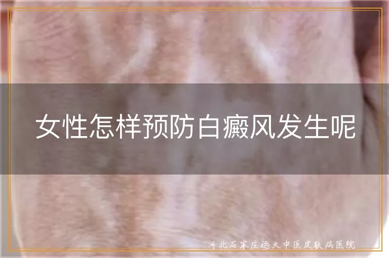 女性如何预防白癜风发生呢,女性白斑预防方法有哪些,女性怎样避免白癜风出现