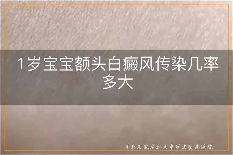 1岁宝宝额头白癜风传染几率,一岁幼儿白斑传染风险,婴儿白癜风会不会传染他人