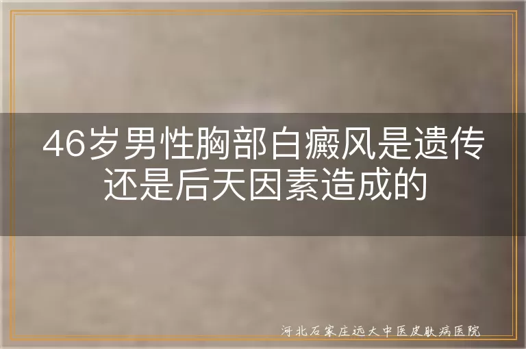 46岁男性胸部白癜风是遗传吗,中年男性胸部白斑形成原因分析,胸部白癜风遗传和后天因素哪个大