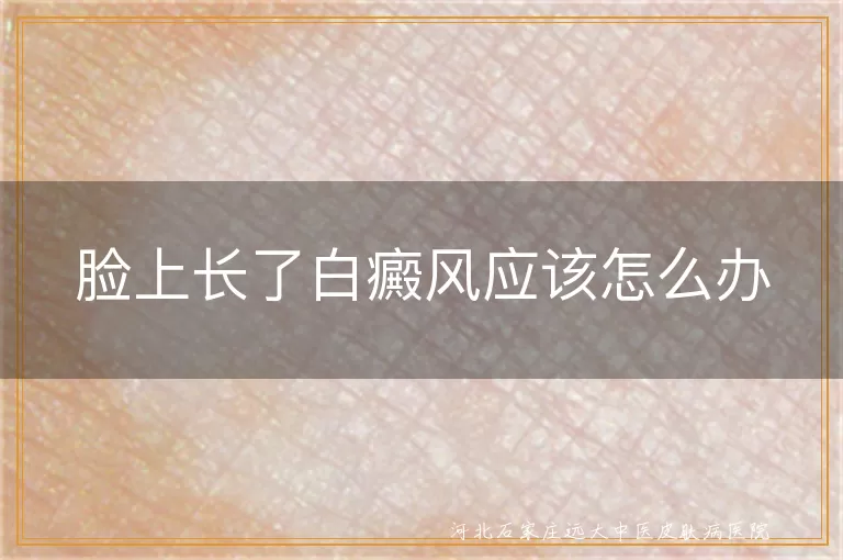 脸上出现白癜风如何治疗,面部白斑怎么调理,脸上长白癜风怎么办