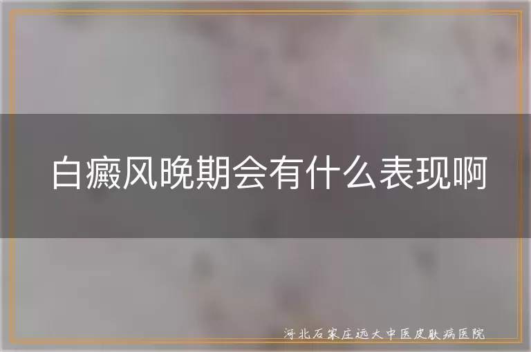 白癜风晚期症状是什么样子,白斑后期会有什么表现啊,白癜风严重时的症状表现