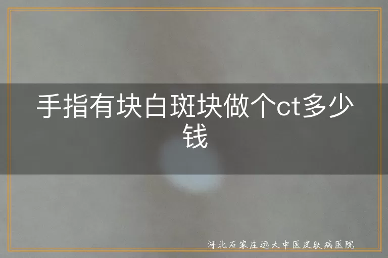 手指白斑做皮肤ct要多少钱,手部白癜风检查费用是多少,手指白斑块检查价格贵吗