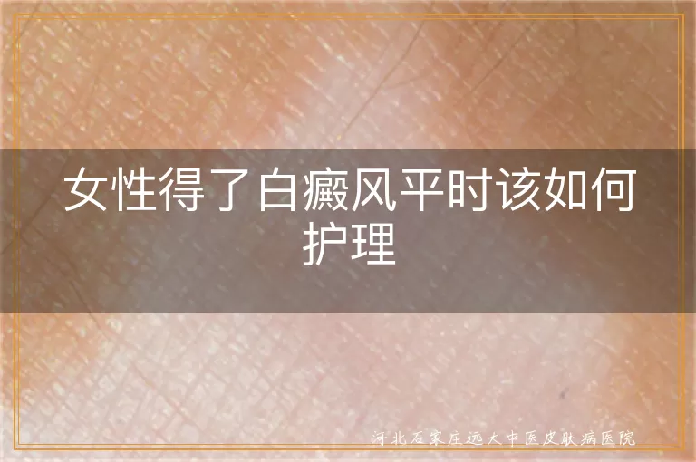 女性得了白癜风平时该如何护理