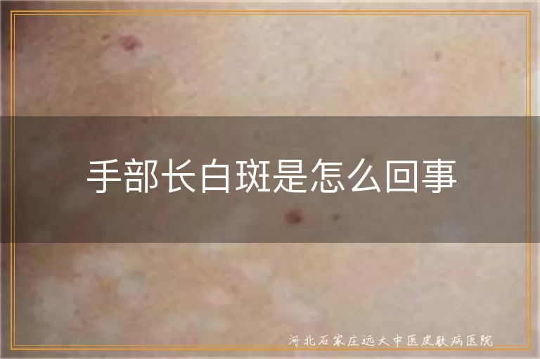 手部长白斑是怎么回事