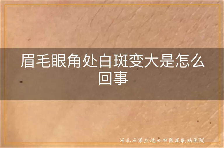 眉毛眼角处白斑变大是怎么回事
