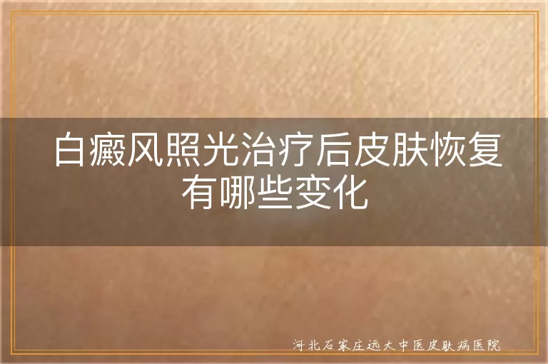 白癜风照光治疗后皮肤恢复有哪些变化