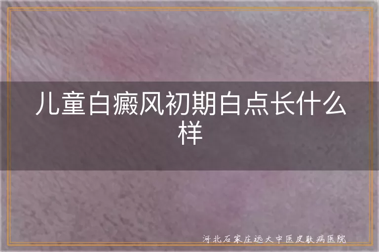 儿童白癜风初期症状是什么样,孩子白癜风早期白斑表现,儿童白斑刚开始出现症状