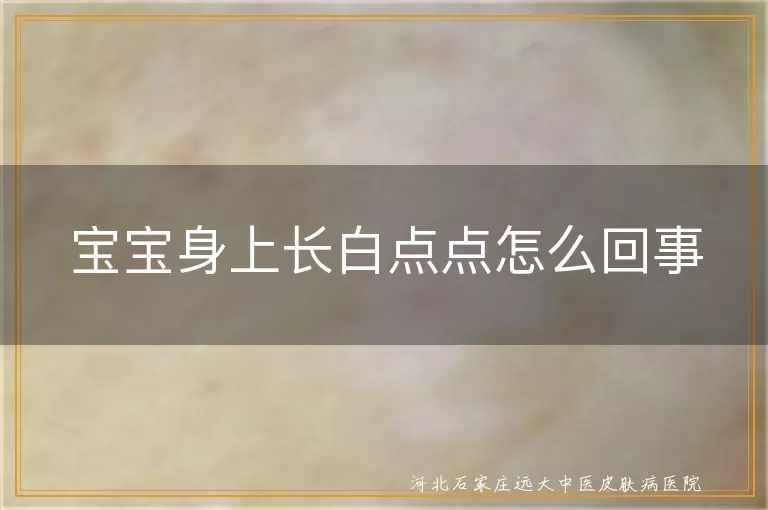 宝宝身上长白斑是怎么回事,婴儿皮肤出现白癜风症状,小孩身上白点是白癜风吗