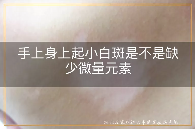 手上起白斑是缺微量元素吗,身上长白斑是不是白癜风,皮肤出现白斑缺乏什么
