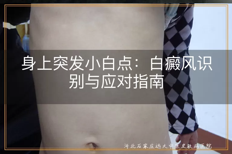 身上突然出现白斑是白癜风吗,皮肤突发小白点病因与检查,发现白斑如何应对与辨别