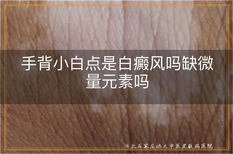 手背小白点是白癜风吗缺微量元素吗