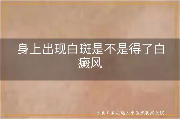 身上出现白斑是不是得了白癜风