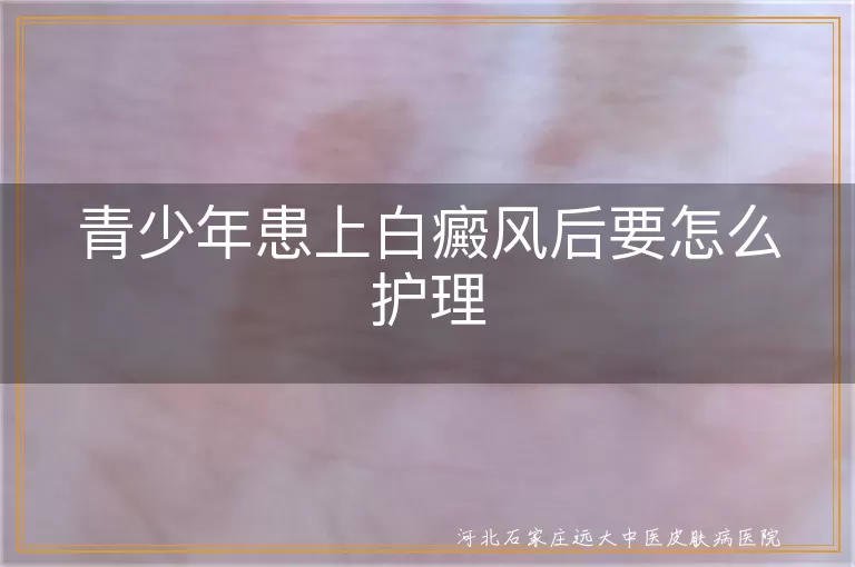 青少年白癜风怎么护理好,青少年白斑日常护理方法,青少年得白癜风如何护理