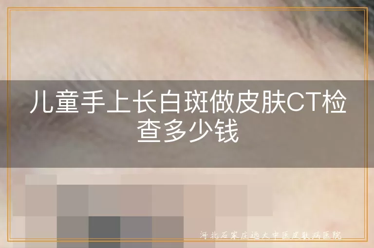 儿童手上长白斑做皮肤CT检查多少钱