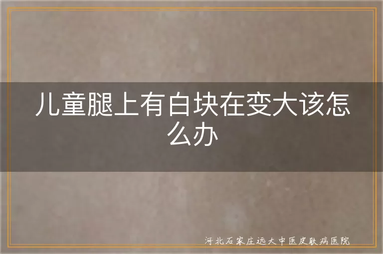 儿童腿上有白块在变大该怎么办
