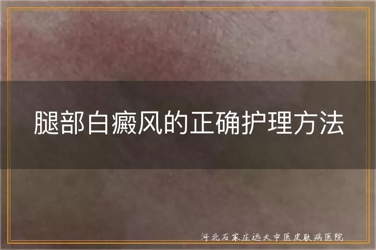 腿部白癜风护理方法有哪些,腿上白斑日常怎么护理好,下肢白癜风护理注意事项