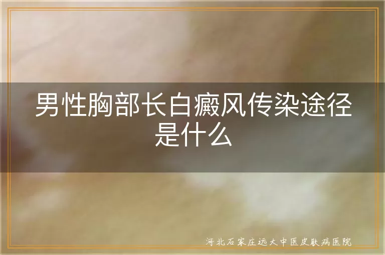 胸口长白斑会不会传染人,男性胸部白癜风传染途径,胸前白斑会传给别人吗