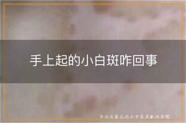 手上长白斑是白癜风吗,手部皮肤出现白斑原因,手上小白点是不是白癜风