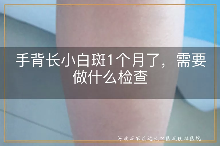 手背长小白斑1个月了，需要做什么检查