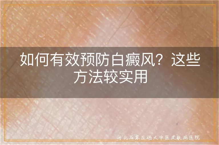 预防白癜风较有效的方法有哪些,日常如何做好白斑预防措施,避免患上白癜风的生活好习惯