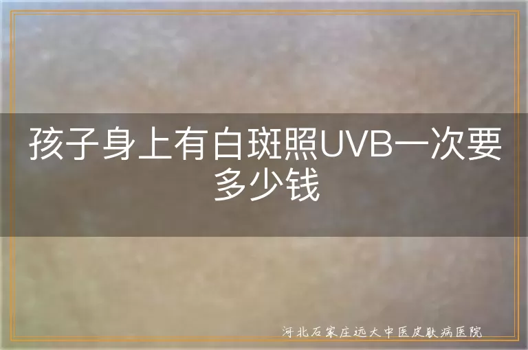 儿童白斑照UVB一次费用多少,孩子身上白斑做光疗一次价格,小孩白癜风照紫外线一次大概花多少钱