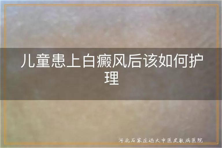 儿童患上白癜风后该如何正确护理,儿童白斑护理家长须知要点,儿童白癜风患者日常照护全攻略