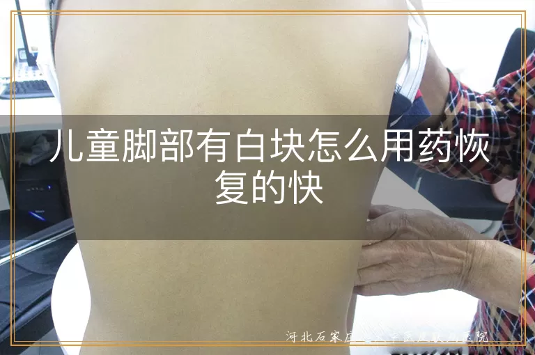 儿童脚上白斑擦什么药恢复快,孩子脚部白癜风用药加速恢复方法,儿童脚上白块怎样用药好得快