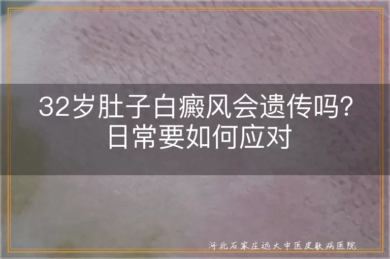 32岁肚子白斑遗传吗如何应对,腹部白癜风会遗传给小孩吗怎么办,肚子上有了白癜风遗传性大不大咋处理