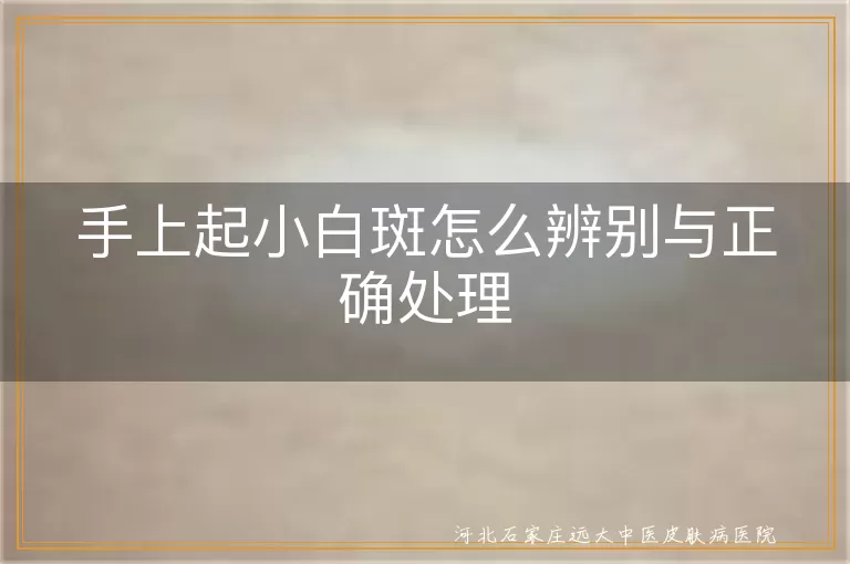手上起小白斑怎么辨别与正确处理