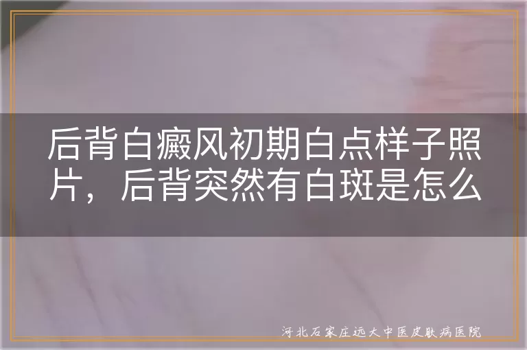 后背白癜风初期白点样子照片，后背突然有白斑是怎么回事，后背长白癜风小白点什么样