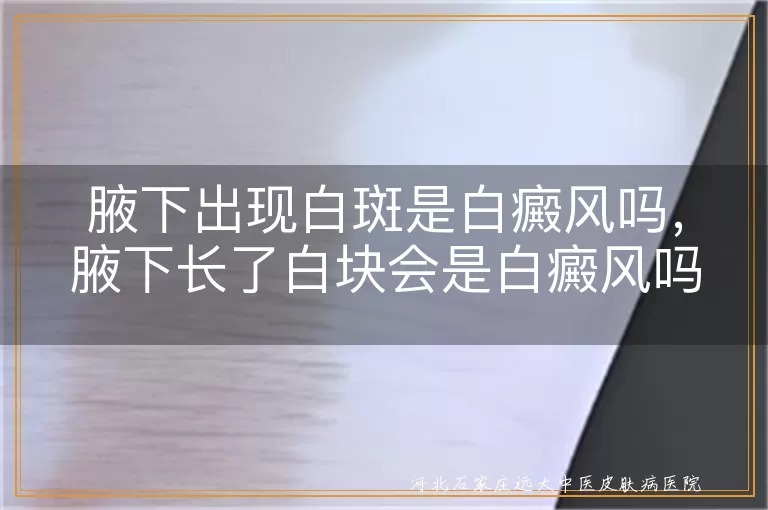 腋下出现白斑是白癜风吗，腋下长了白块会是白癜风吗，腋窝皮肤变白是不是白癜风