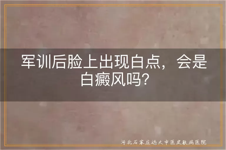 军训后脸有白点是白癜风吗,军训暴晒后脸上白斑怎么回事,脸上出现白点军训后白癜风前兆
