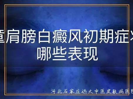 儿童肩膀白癜风初期症状有哪些表现