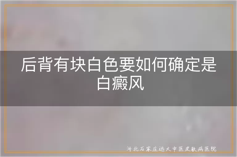 后背出现白斑怎么判断是白癜风, 背部长白色块状辨别白癜风方法, 后背白块是不是白癜风的简单自测