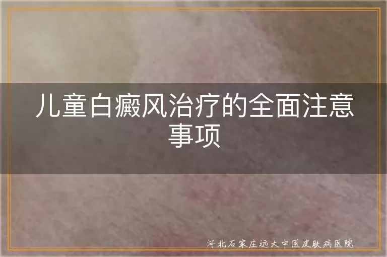 儿童白癜风治疗需牢记的全面注意事项,儿童白斑治疗家长必看的注意事项,儿童白癜风全面治疗与护理注意要点
