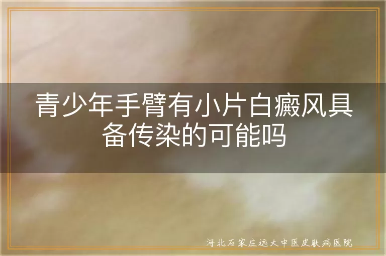 青少年手臂白癜风传染吗,青少年白斑会传染别人吗,手臂小面积白癜风传染性