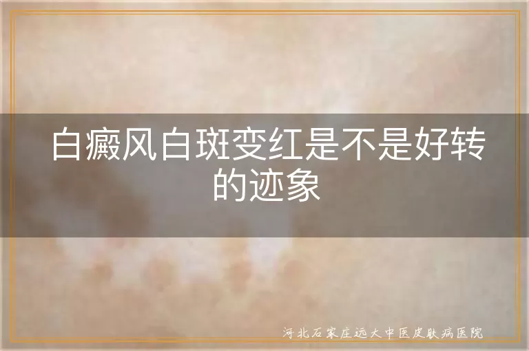 白癜风白斑变红是不是好转的迹象