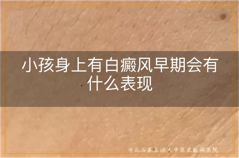 孩子身上出现白斑是白癜风早期吗,小孩白癜风刚开始有哪些症状表现,小孩皮肤白斑早期是不是白癜风