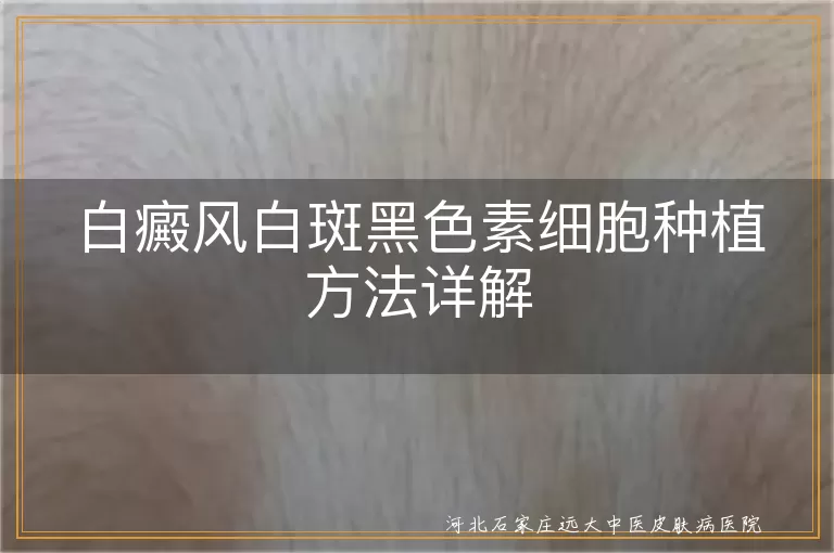 白癜风白斑黑色素细胞种植方法详解