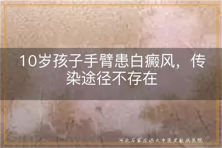 10岁孩子手臂患白癜风，传染途径不存在