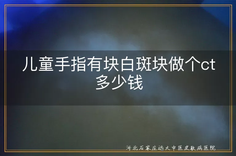 儿童手指白斑做皮肤ct多少钱,儿童手指白斑块检查费用,儿童白癜风白斑做ct要多少钱