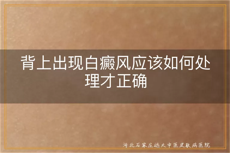 背上长白斑怎么办,背部白癜风日常护理方法,背上白癜风能治好吗,背部白斑怎么改善