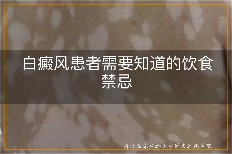 白癜风患者饮食禁忌有哪些,白斑病人不能吃什么食物,白癜风日常忌口清单