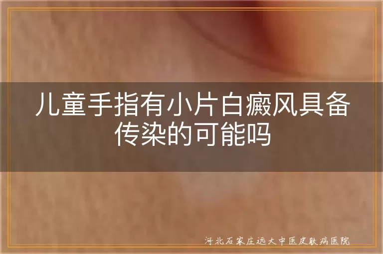 儿童手指白斑具备传染性吗,儿童手指白癜风会传染给别人吗,儿童手指小片白斑传染吗