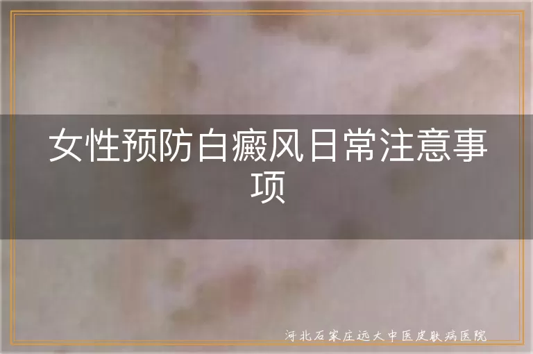女性预防白癜风的方法,女性怎样预防白斑出现,女性如何避免白癜风发生
